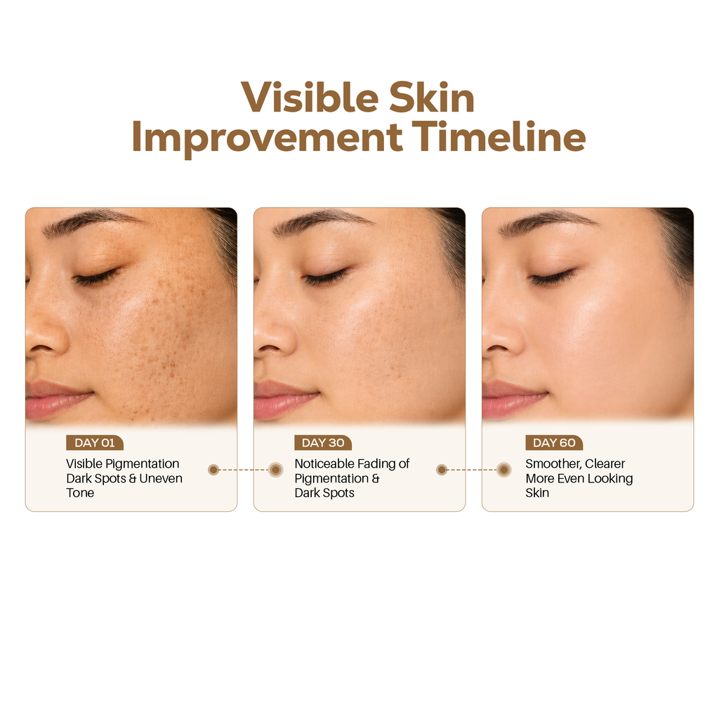 NIORÉ Ultra-Brightening Kojic Face Soap with Foaming Net – 100g