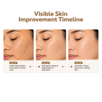 NIORÉ Ultra-Brightening Kojic Face Soap with Foaming Net – 100g